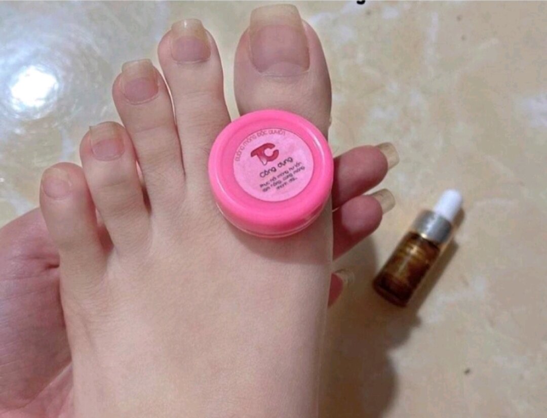 Combo dưỡng cứng, hồng móng và đánh bay nấm móng, hư khoé