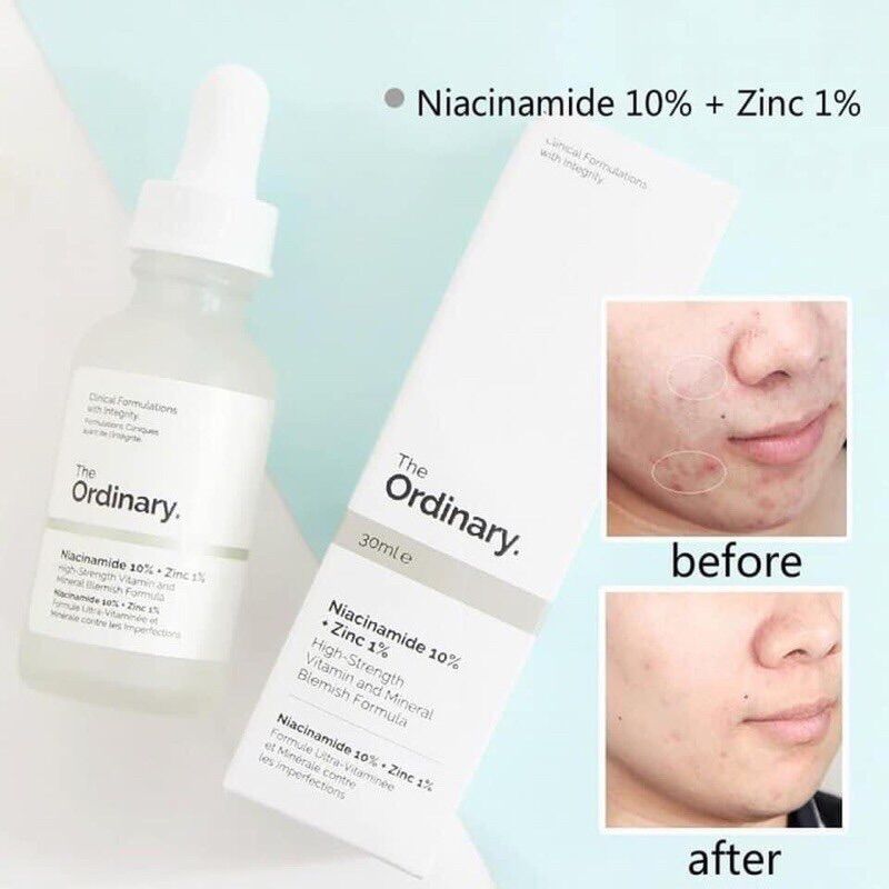 [HCM](Bill Mỹ-USA) Tinh Chất Niacinamide 10% + ZinC 1% - The Ordinary