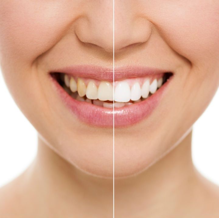 Gói Nước Súc Miệng Fresh Thơm Miệng Vị Trái Cây Thơm Mát