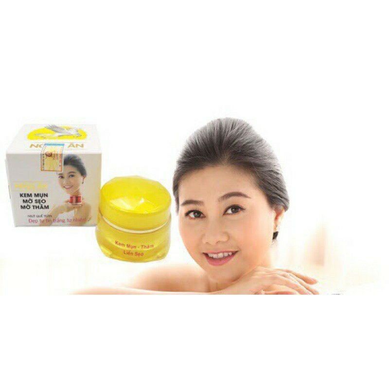 Kem mụn - mờ sẹo - mờ thâm ngọc ân 12g