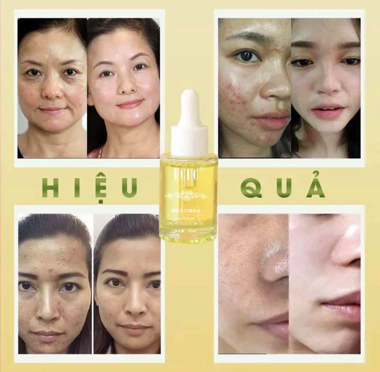 Serum Trẻ Hoá Da UCUC Bao Bì Mới (Hàng Chính Hãng)Serum Chống Lão Hoá Da