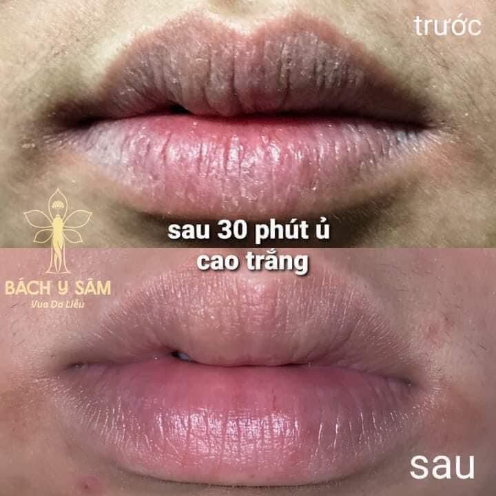 ✅CAO TRẮNG DA mẫu mới { BÁCH Y SÂM } { NHẤT MỘC HƯƠNG }