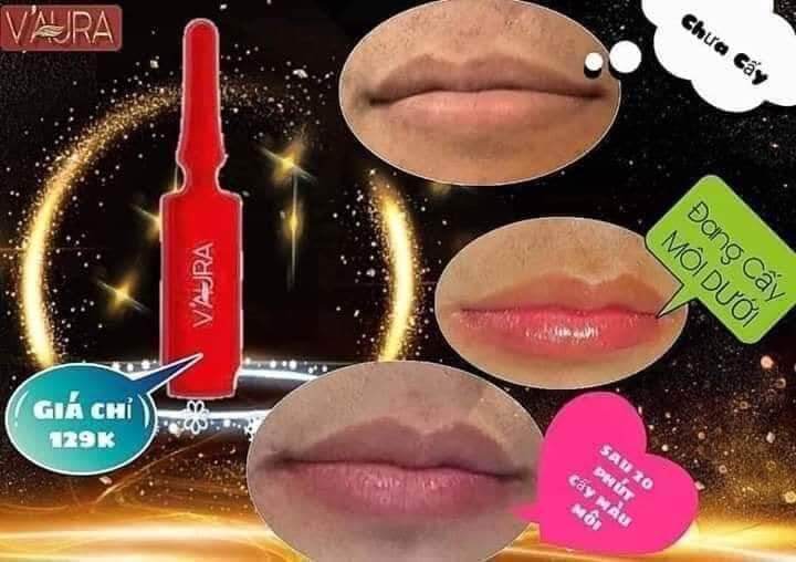 [Mua Cấy Môi Tặng Mask Môi ] Babier Lips Volume V2 Tinh Chất Làm Hồng Môi Khử Thâm Môi Khô Môi ( Thay Phun Xăm