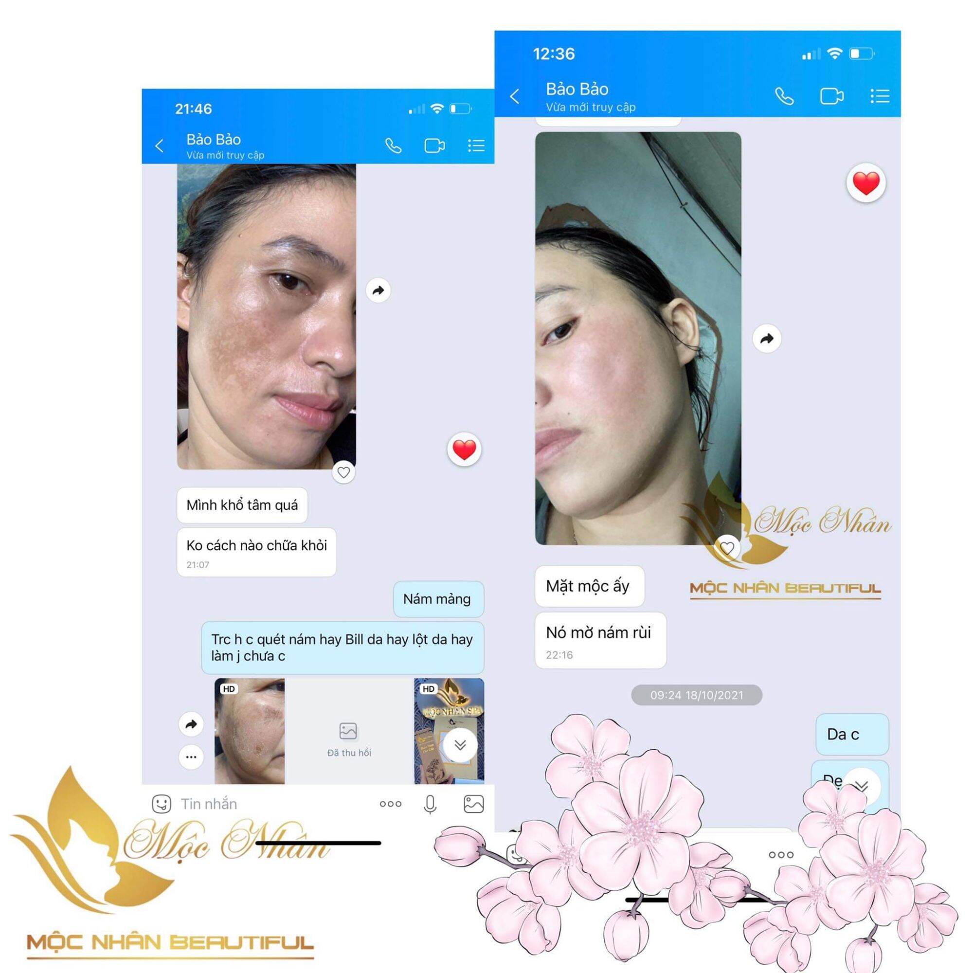 Đông Y Mộc Nhân Tái Tạo Da Cao Cấp