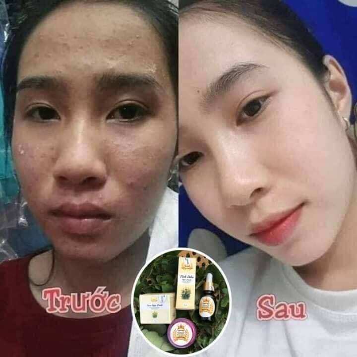 Bộ đôi Kem Face Ngọc Oanh