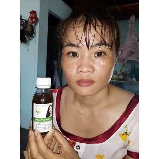 THẢO MỘC NÁM DA TRẦN KIM HUYỀN
