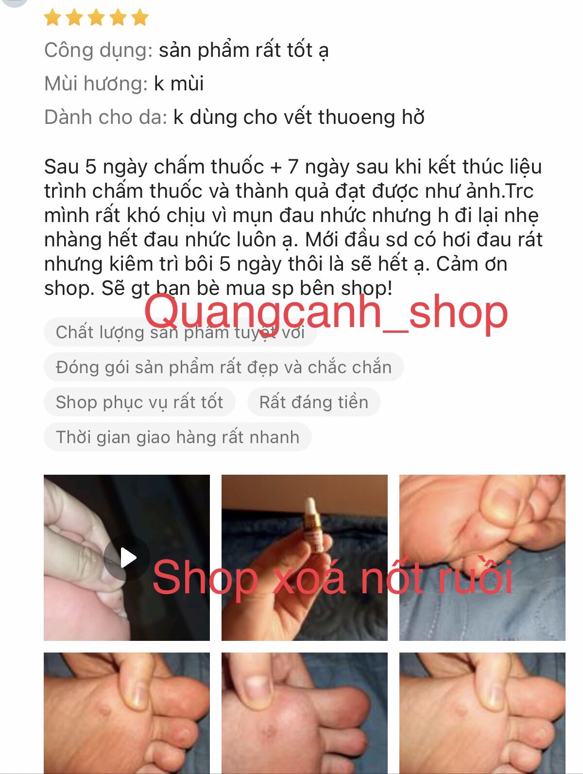 Tẩy nốt ruồi, mụn cóc, mụn cơm, mụn thịt, mắt cá hiệu quả nhanh