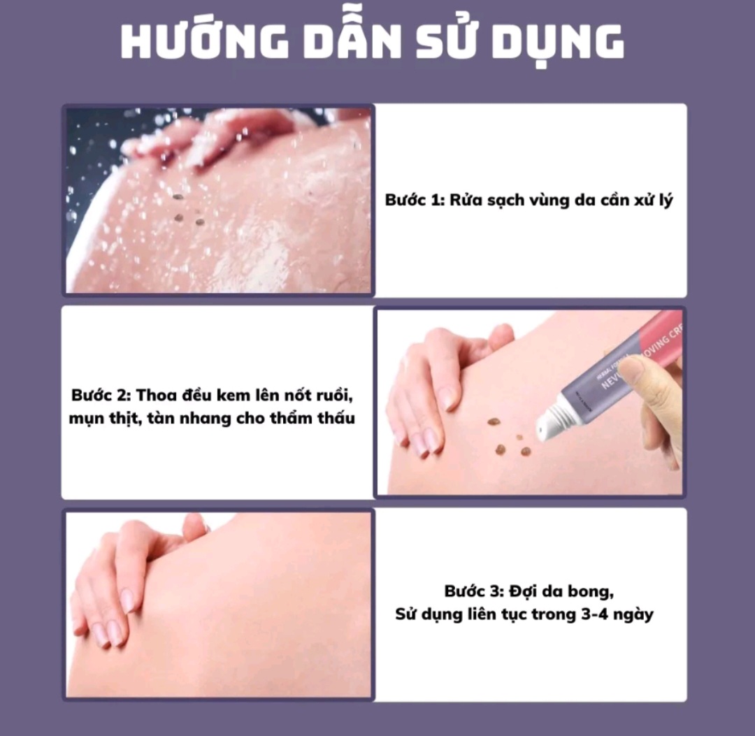 [CHÍNH HÃNG] Kem EELHOE tẩy nốt ruồi, mụn thịt