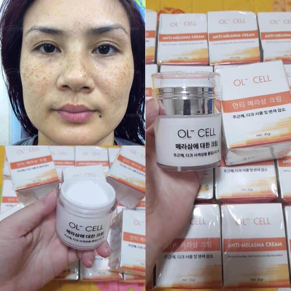 Kem nám tàn nhang ol cell ( cam kết chuẩn )