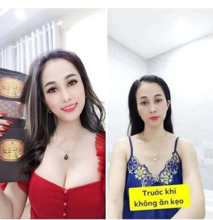 Kẹo mầm nở ngực lúa mạch thảo mộc 37 SÂM TỐ NỮ PLUS tăng kích thước vòng 1 giúp ce thoát lép