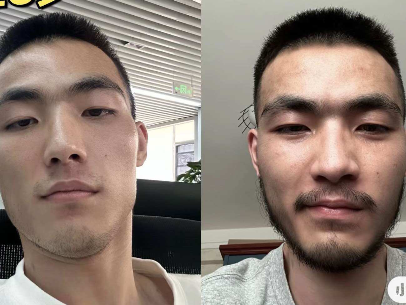 (Tặng 3 Ống LCLT) Hộp 6 lọ Minoxidil 5% dạng lỏng mọc râu tóc, chân mày