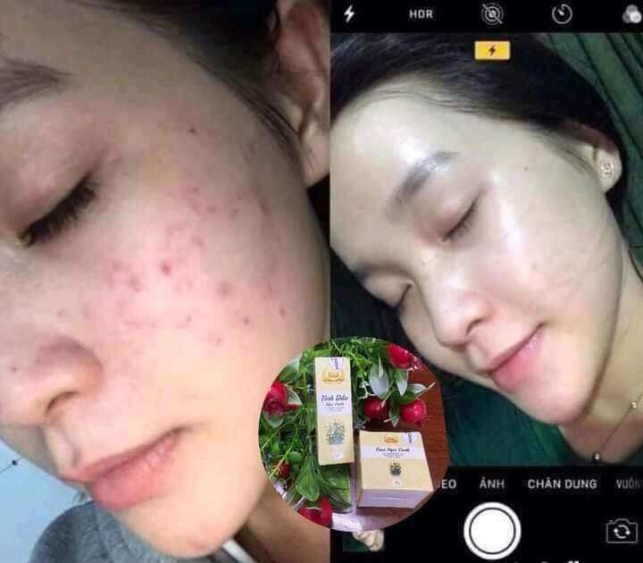 kem Face Ngọc Oanh