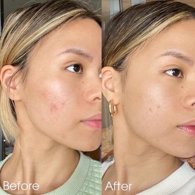 Sample 1,5ml Tinh Chất Serum Làm Sáng Da & Mờ Thâm Mụn kiehl's Clearly Corrective™ Dark Spot Solution
