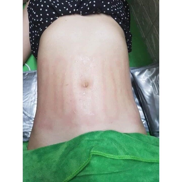 Đai Cuốn Nóng Giảm Béo, Giảm Mỡ Bụng (Đai quấn nóng)