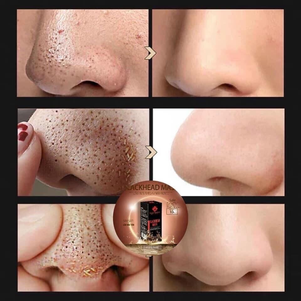 Ủ mụn đầu đen leau claire 12ml {Có kèm giấy lột}