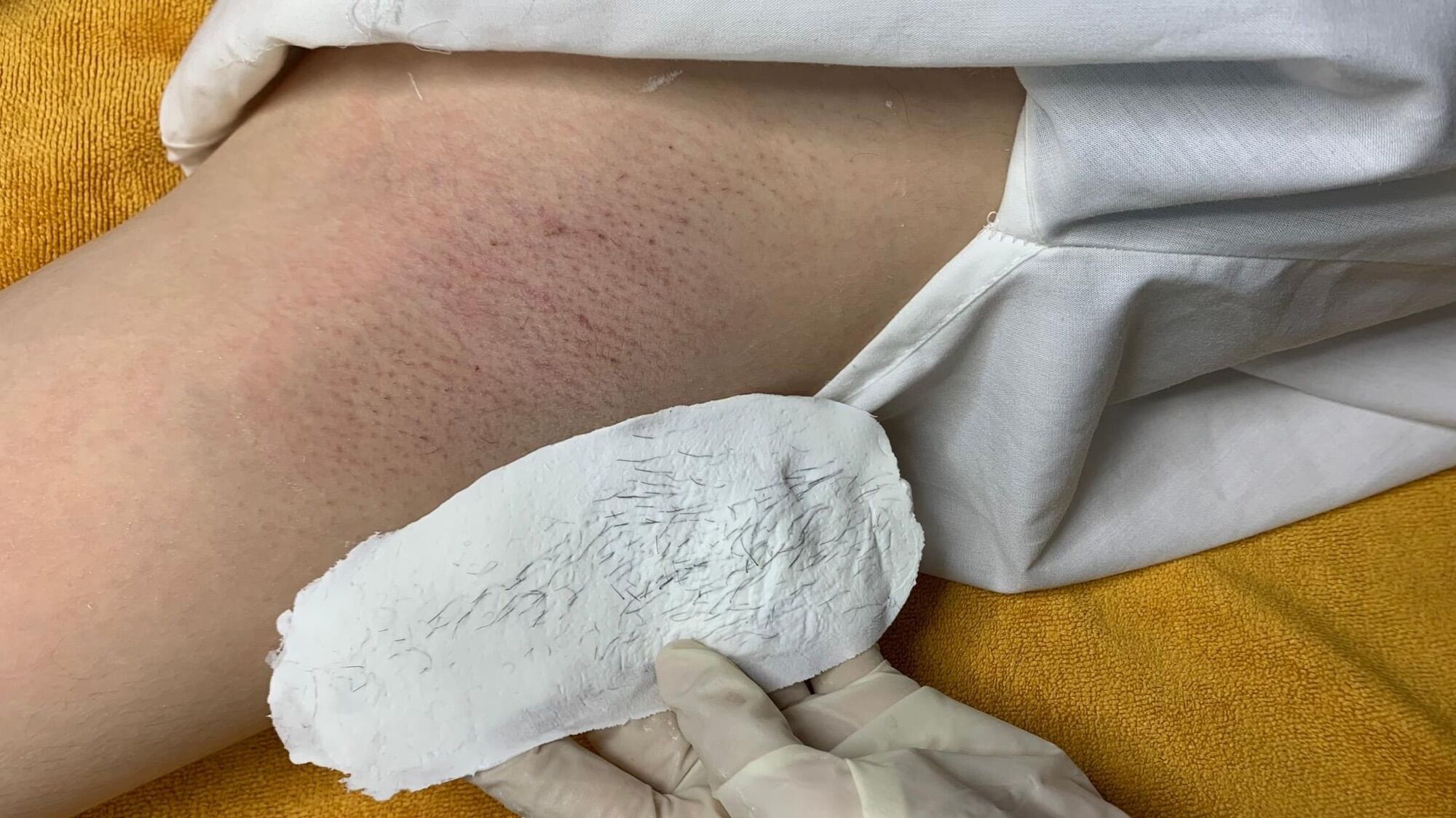 COMBO WAX LÔNG 99K 100G SÁP , CHÉN SILICON, SERUM MỠ