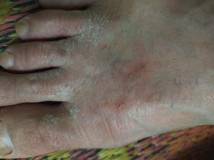 KEM ĐA NĂNG ĐÔNG Y BÀ VÂN