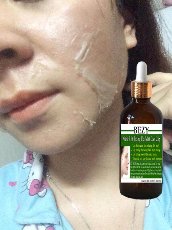 Peel da mặt xóa nám sạm tàn nhang trắng da bezy