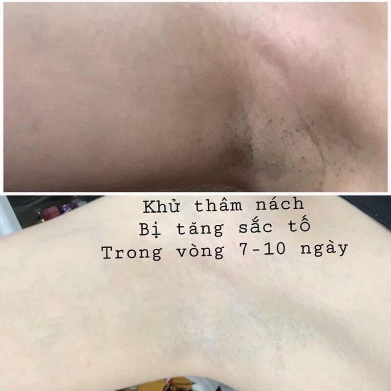 Kem mờ thâm body Vivid White