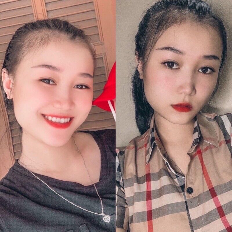 Xịt Kích Mọc Tóc Kiều Linh