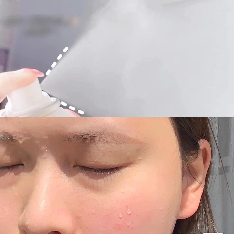 XỊT KHOÁNG VICHY