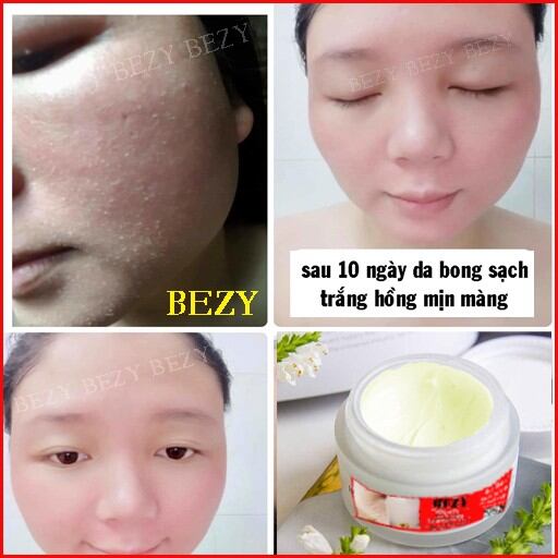 Kem Bong Da Tái Tạo Mờ Nám Sạm Bezy