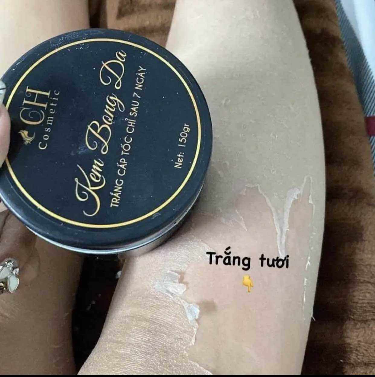 3 hộp kem bong da CH mua 3 tặng 1 hộp kem body 200gr