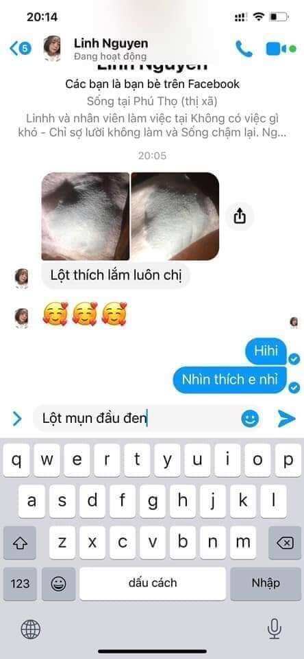 Gel lột mụn acnes chính hãng