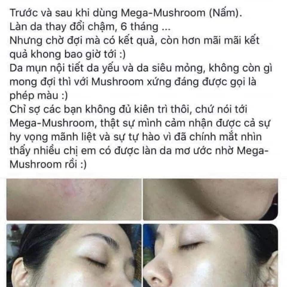 Toner Nấm nhà Origin