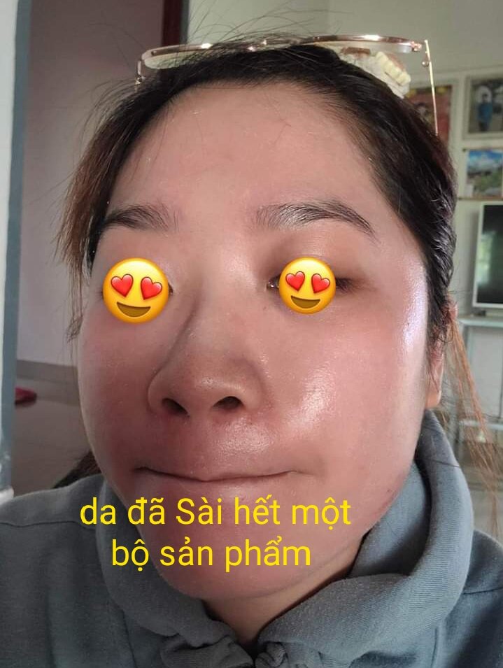 Bộ kem t&t đánh bay nám, mụn ,da đen sạm ,đạc kết quả lên đến 99%