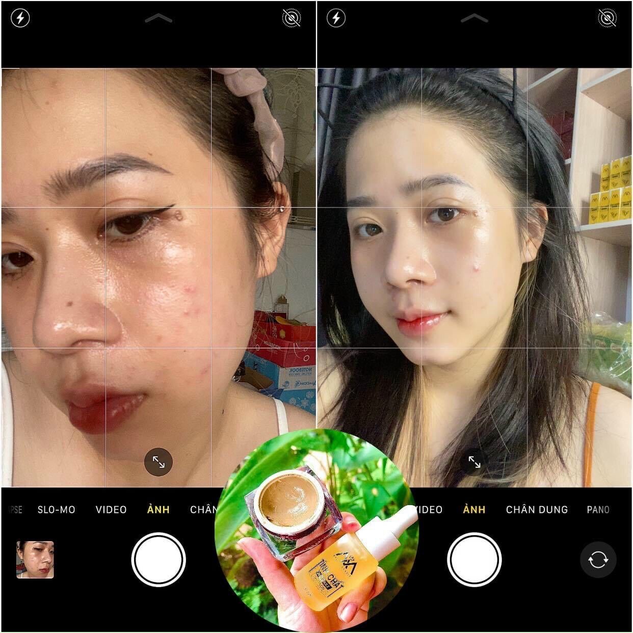 Hủ to Cao mụn sâm đỏ 36 vị 15gr