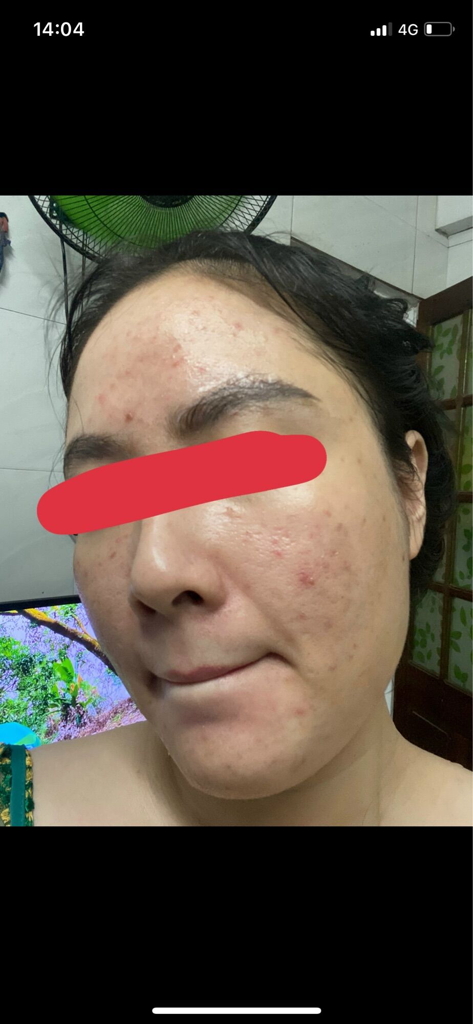 CỐT NHÂN SÂM TR.Ị M.ỤN,THÂ.M