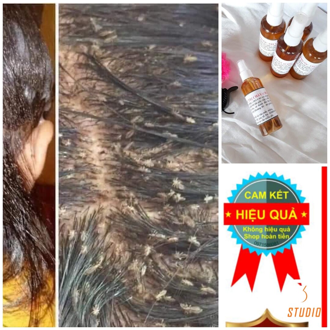 Ủ chấy gia truyền dân tộc giao đỏ 60k