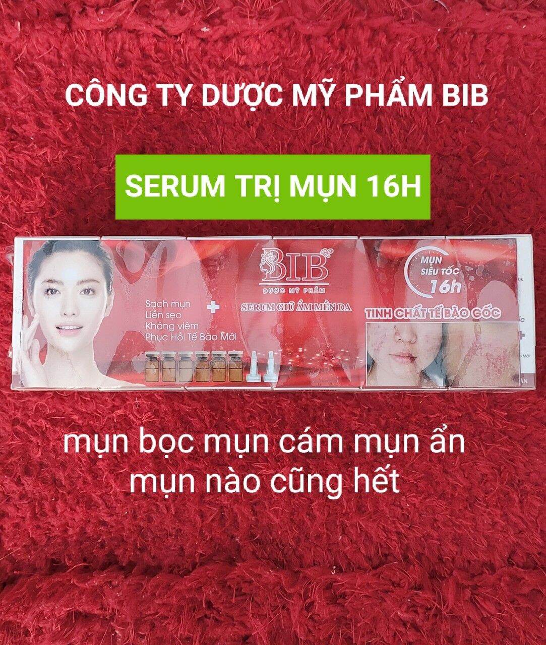 Sirum Mụn Chuyên Sâu (Tinh Chất Tế Bào Gốc)