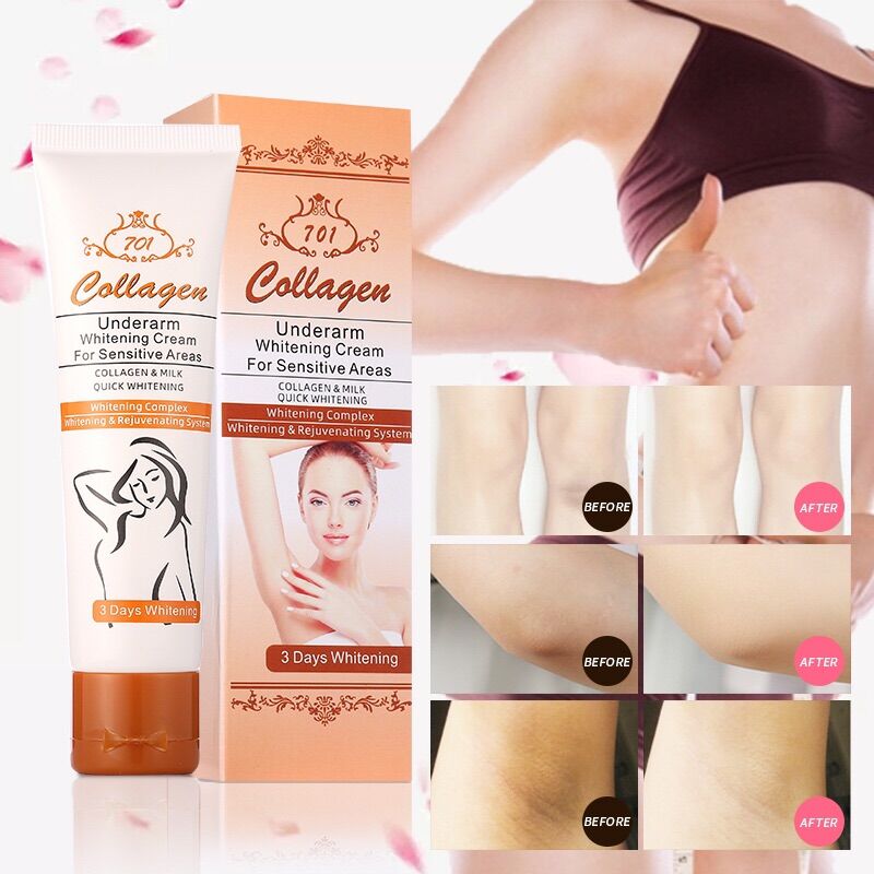 Kem Tri Thâm Đa Năng Collagen 701 xoá sạch thâm sạm vùng kín, đầu gối