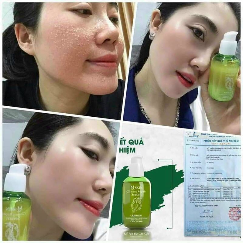 [HCM] Thay da MQSKIN 80ml (xưng - không xưng )