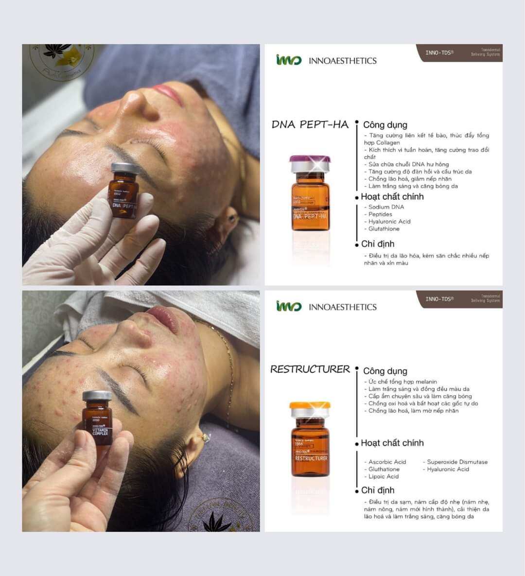 Tinh chất mợ nám trắng da INNO - TDS RESTRUCTURER 5ml/ lọ
