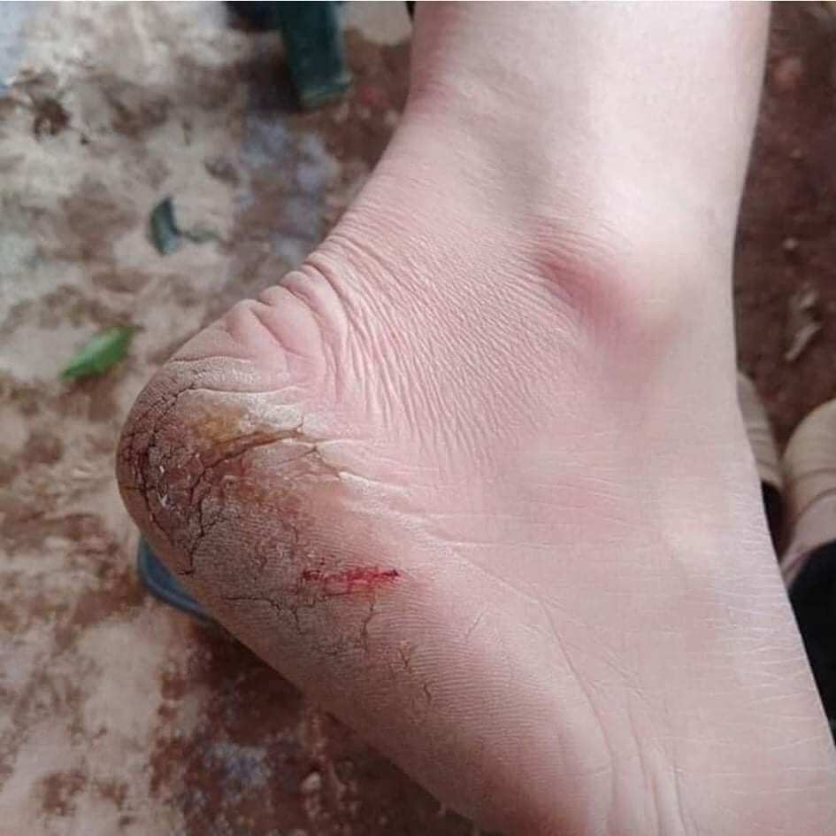 kem dưỡng da chân, trị nứt gót chân Oriflame.