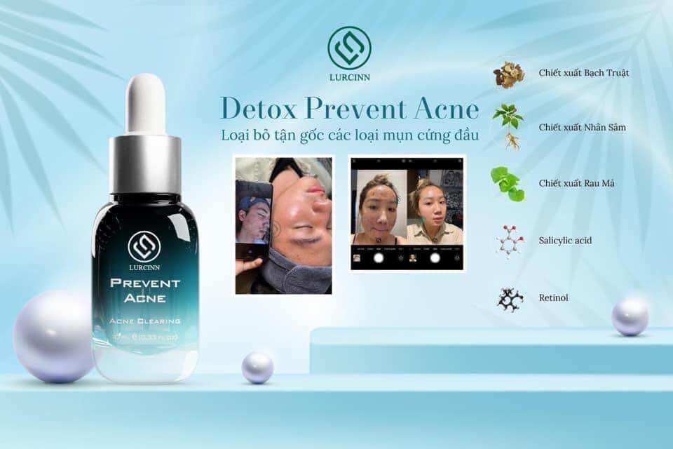 Serum mụn DETOX PREVENT ACNE