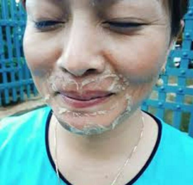 BEZY Lột Thay Trắng Da Mờ Thâm Nám Thái Lan