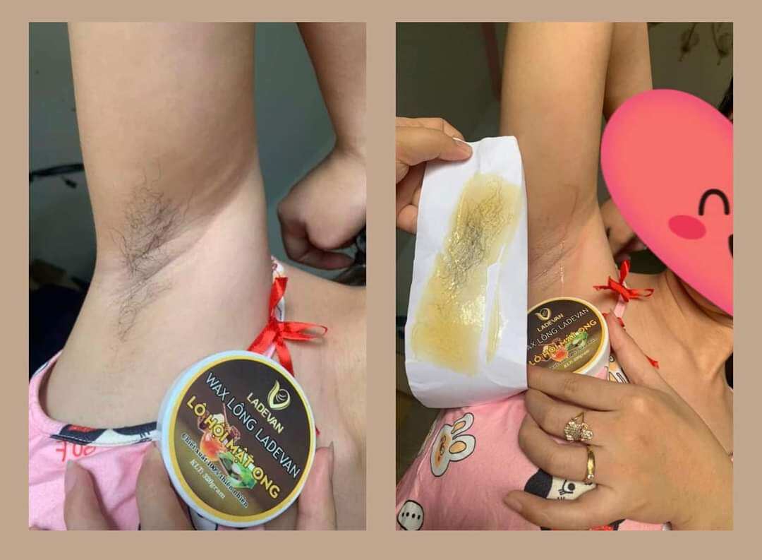 Combo wax lông Lô hôi hộp 230gr + mỡ trăn triệt lông vĩnh viễn, Triệt lông tay, chân nách