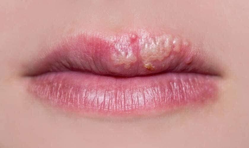 Dưỡng Vaseline Rose Mụn Nước Môi Sau Xăm
