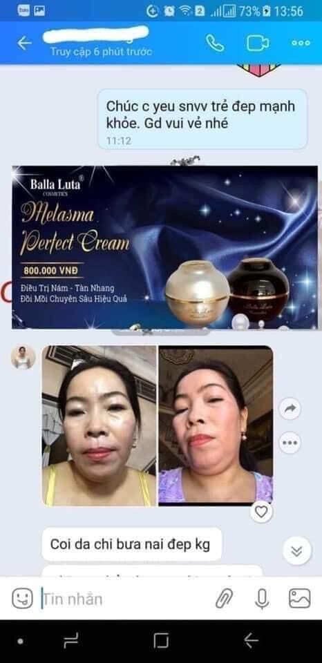 FACE NÂNG CƠ BALLA LUTA