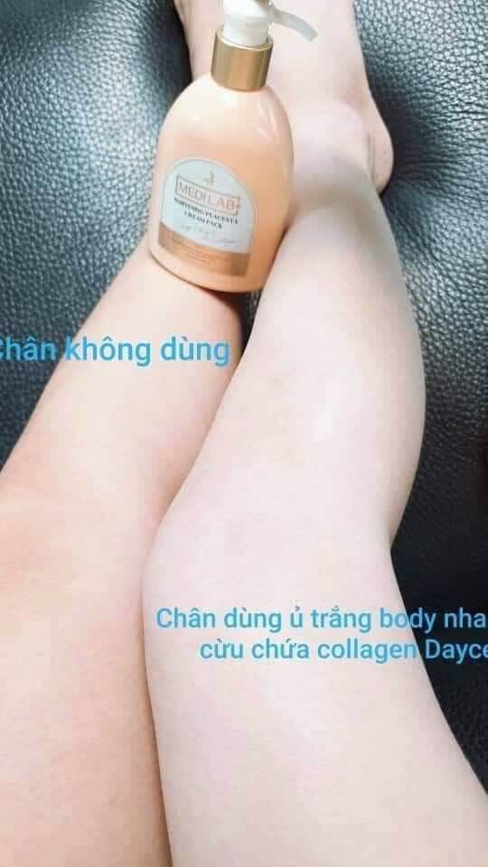 body nhau thai cừu