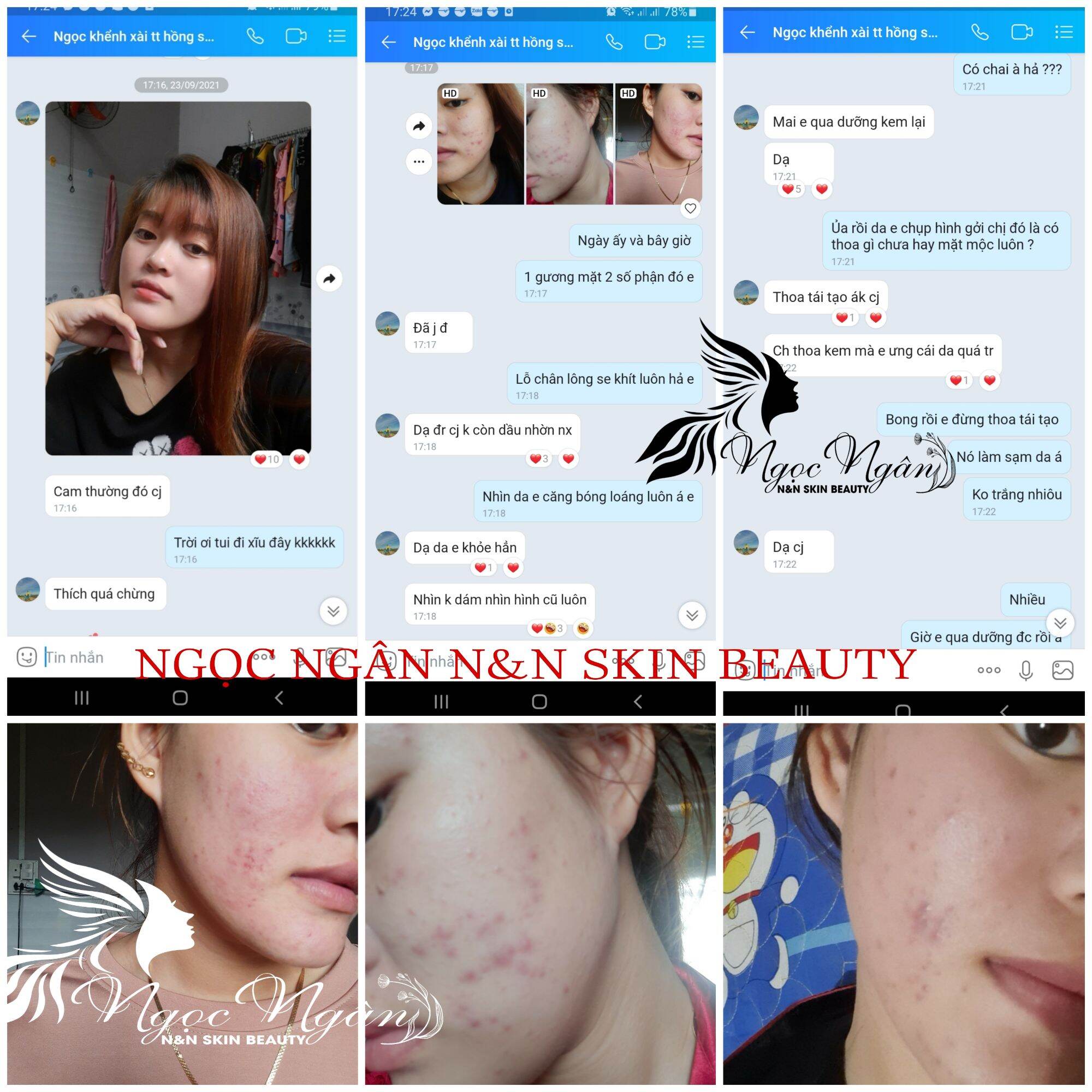 HỒNG SÂM TÁI TẠO DA