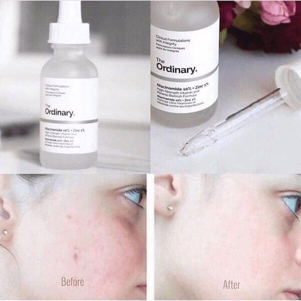 Tinh chất The Ordinary Hyaluronic Acid 2% ngừa mụn, trắng da 30ml