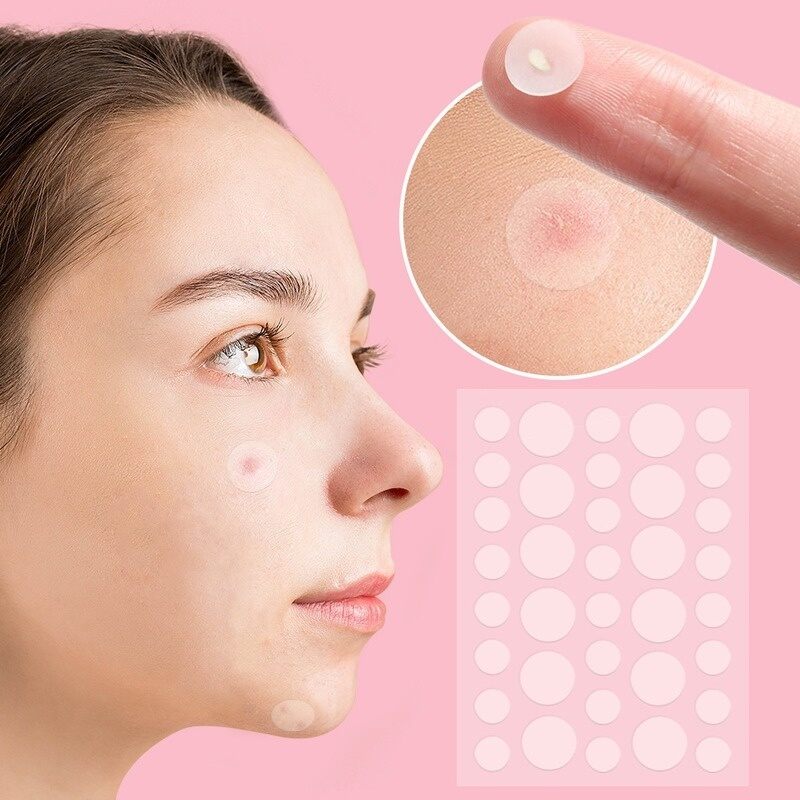 Set 36 Miếng Dán Che Mụn, Che Khuyết Điểm Bảo Vệ Da