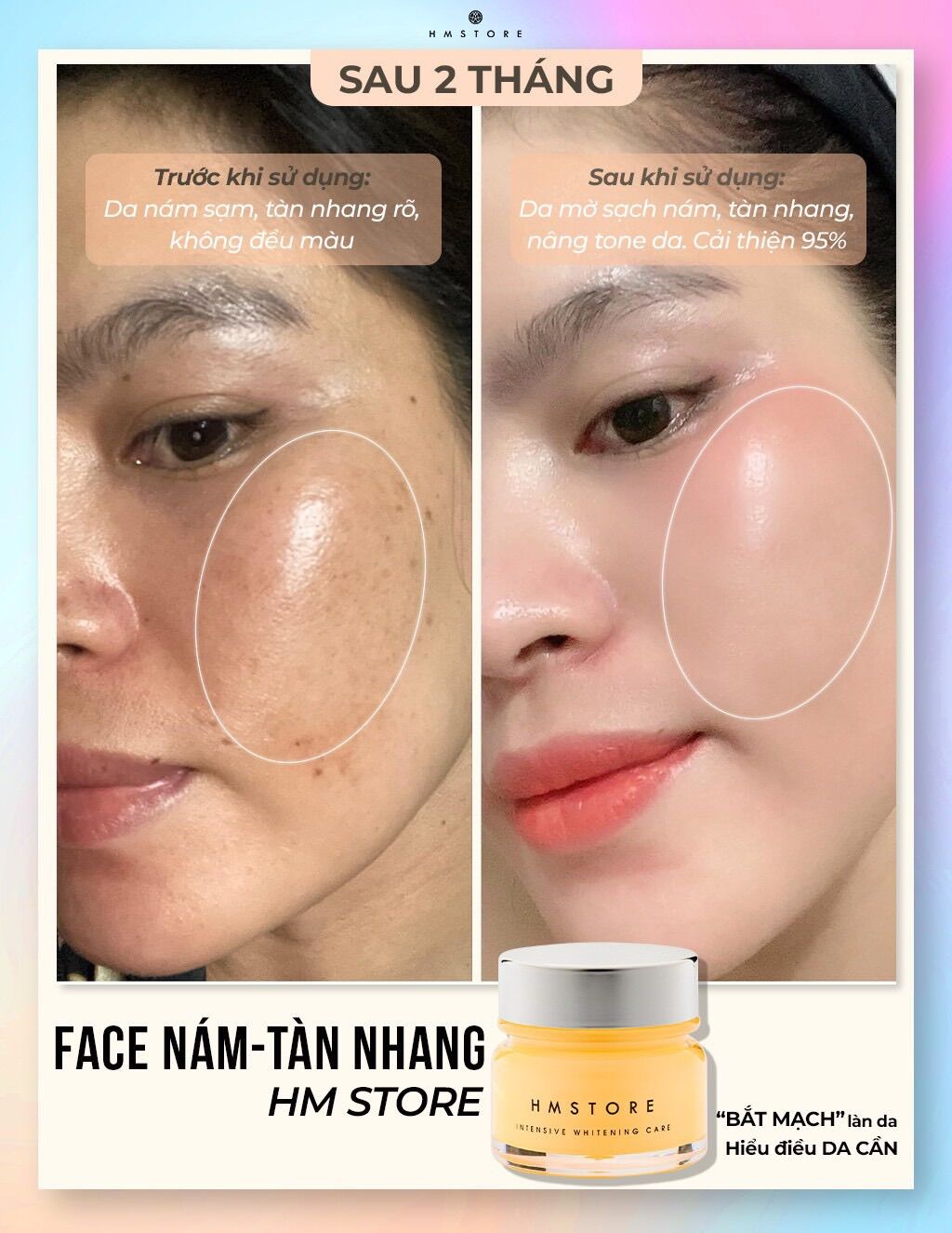 Face Nám Tàn Nhang Jussmy HM STORE