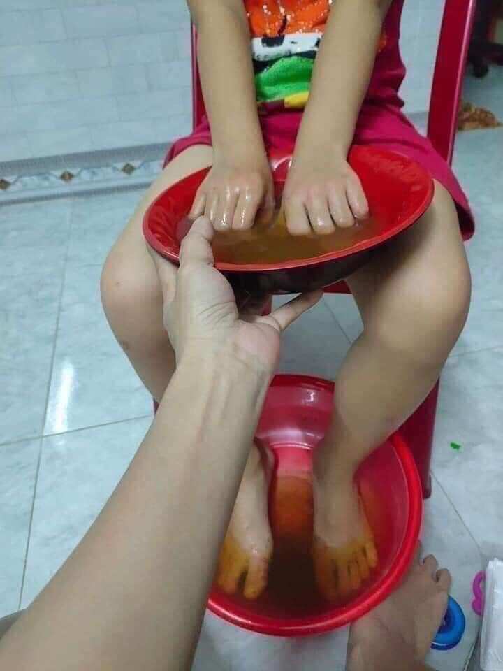 THẢO MỘC BÔI DA _ VIÊM DA DEN tkh