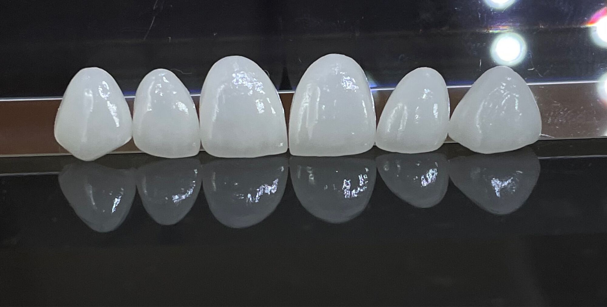 Miếng Dán Răng Sứ